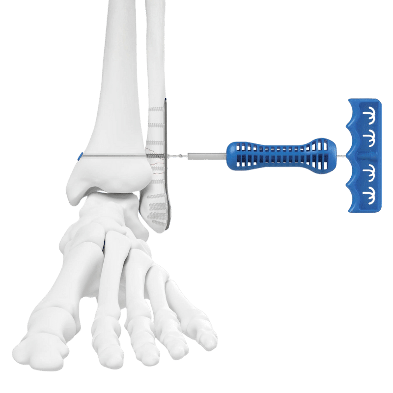 Pince à Cordon RipCord SOS – L’outil Indispensable Pour Serrer Vos Cordons En Un Clin D’œil !